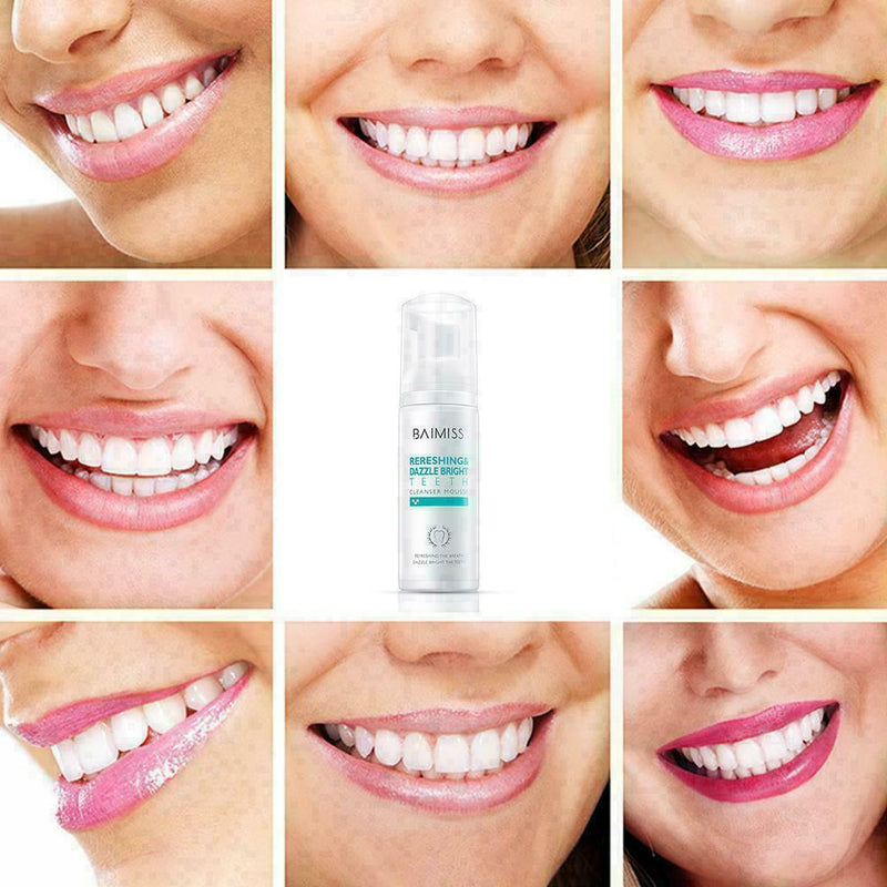 Fresh Shining Tooth-Cleaning Mousse Toothpaste TEETH WHITENING Hygiene NEW U8V1