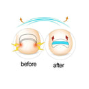Ingrown Toenail Straightening Clip Glue Correction Curved Hot Brace Kit P3Y8