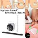 Ingrown Toenail Straightening Clip Glue Correction Curved Hot Brace Kit P3Y8