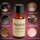 Hair Growth Liquid Oil Natural Organic Regrowth Treatment Hot