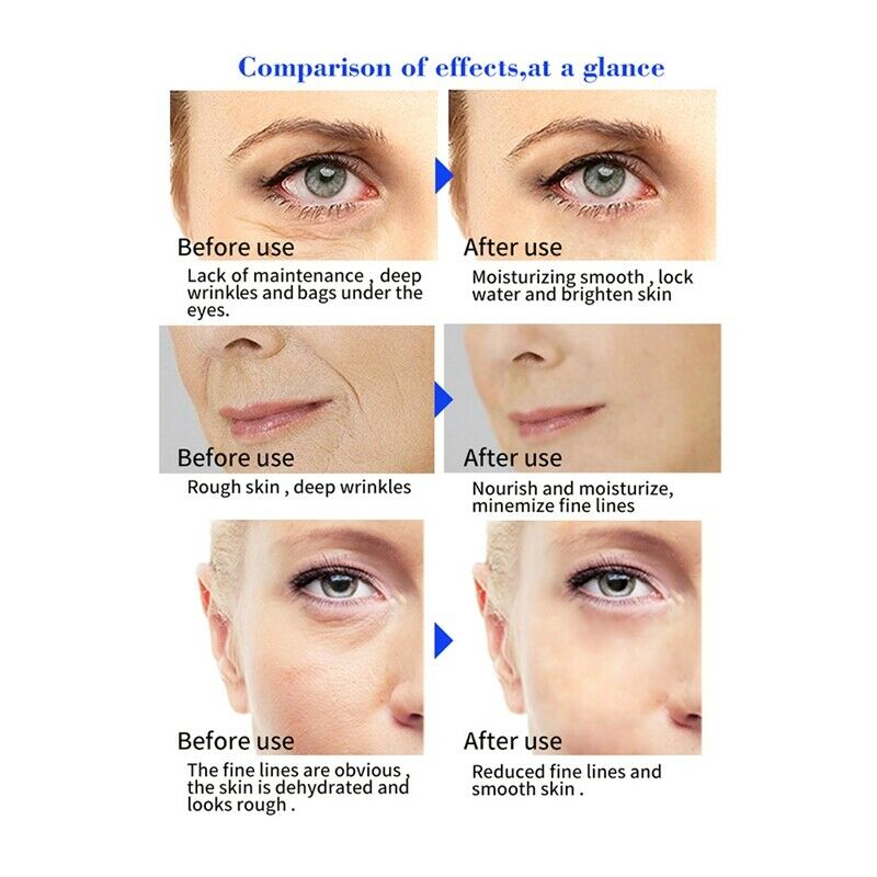 Fair King Tea Tree Hyaluronic Acid Injection Face Serum Liquid Tights Anti- M6B9