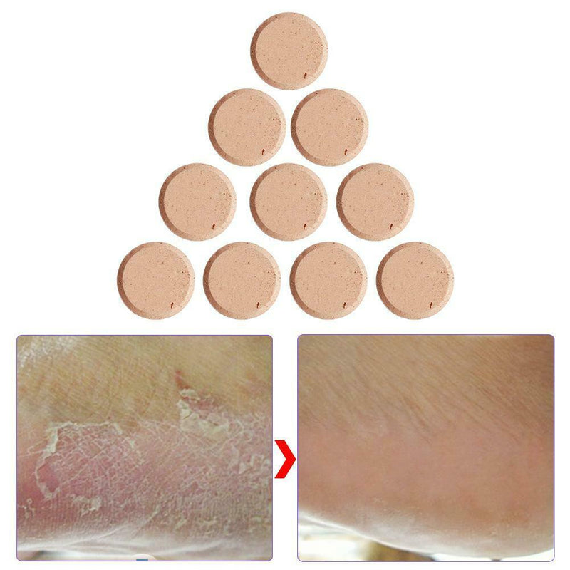 10pcs Ginger Massage Effervescent Tablets Treatment Anti-Swelling Foot SPA