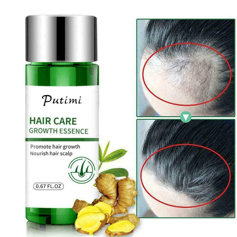 Hair Growth Dense Regrowth Ginger Serum Oil Anti Loss Treatment Essence 20M T1W7