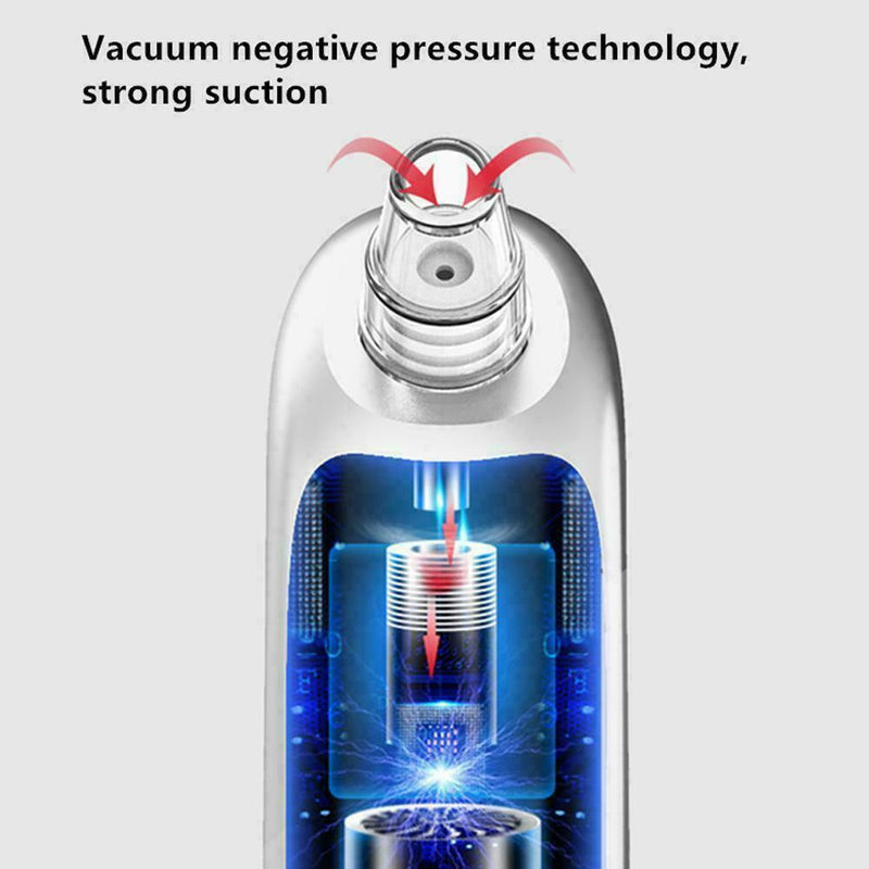 Electric Acne Blackhead Vacuum Cleaner Skin Care Tool Deep Clean Face Pores X5R9