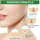 24Pcs Hydrocolloid Acne Remover Pimple Patch Stickers Tag Removal Invisible