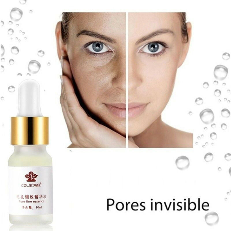 Pore Shrinking Essence Tightening Oil-control Moisturizing Blackhead Remover E&S