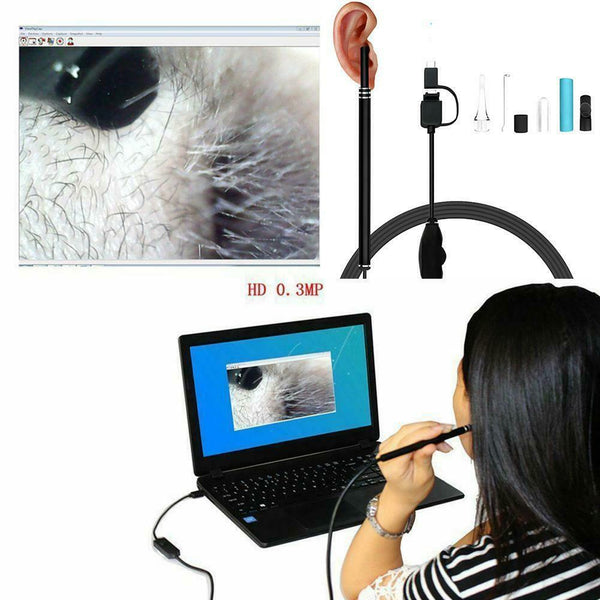 3 In 1 Visual Ear Canal Endoscope Ear Cleaner With Pixels Camera Endoscope Kit