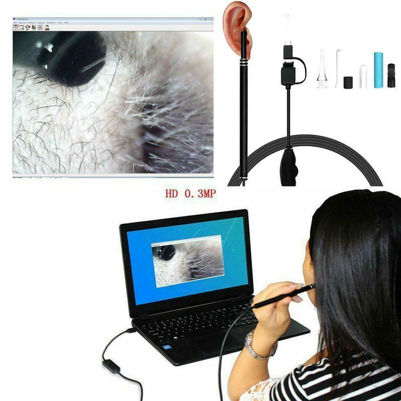 3 In 1 Visual Ear Canal Endoscope Ear Cleaner With Pixels Camera Endoscope Kit