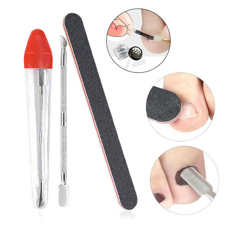 3Pcs Nail Pedicure Elastic Patch Clip Brace Bunion Ingrown Toenail Correct a1 Gw