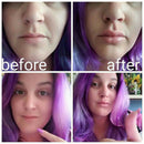 Women Sexy Ladies Lips Plumper Enhancer Enlarger Pump Beauty Tool