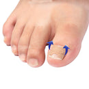 50x Toenail Corrector Stickers Toe Nail Elastic Patch Corrector Correction