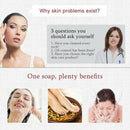 Medicated Soap Conditions Acne  Anti Fungus Bath Soap OZ