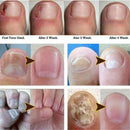 Special Nail Treatment Liquid Grey Nail Clear Repair Enhanced Gray Nail Tre
