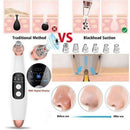 Blackhead Suction Removal Pore Cleaner Electric Skin Cleaning W/6 Suction Heads