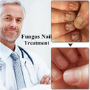 Special Nail Treatment Liquid Grey Nail Clear Repair Enhanced Gray Nail Tre