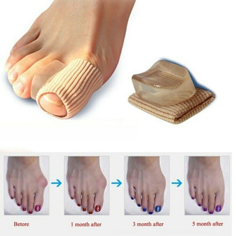 1x Gel Toe Separator Straightener Bunion Spacers Corrector Hallux Valgus Relief.