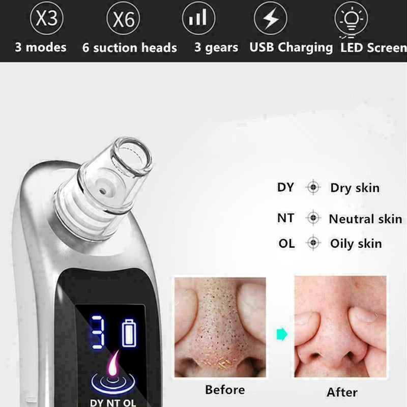 Electric Acne Blackhead Vacuum Cleaner Pore Skin Care W9C8 Deep Cleansing J J2G5
