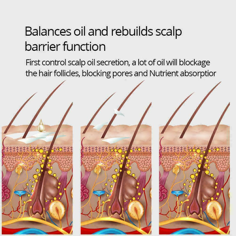 Hair Growth Essence Essential Oil Liquid Spray Nourish Roots Shiny Pr X2G8 V7S9