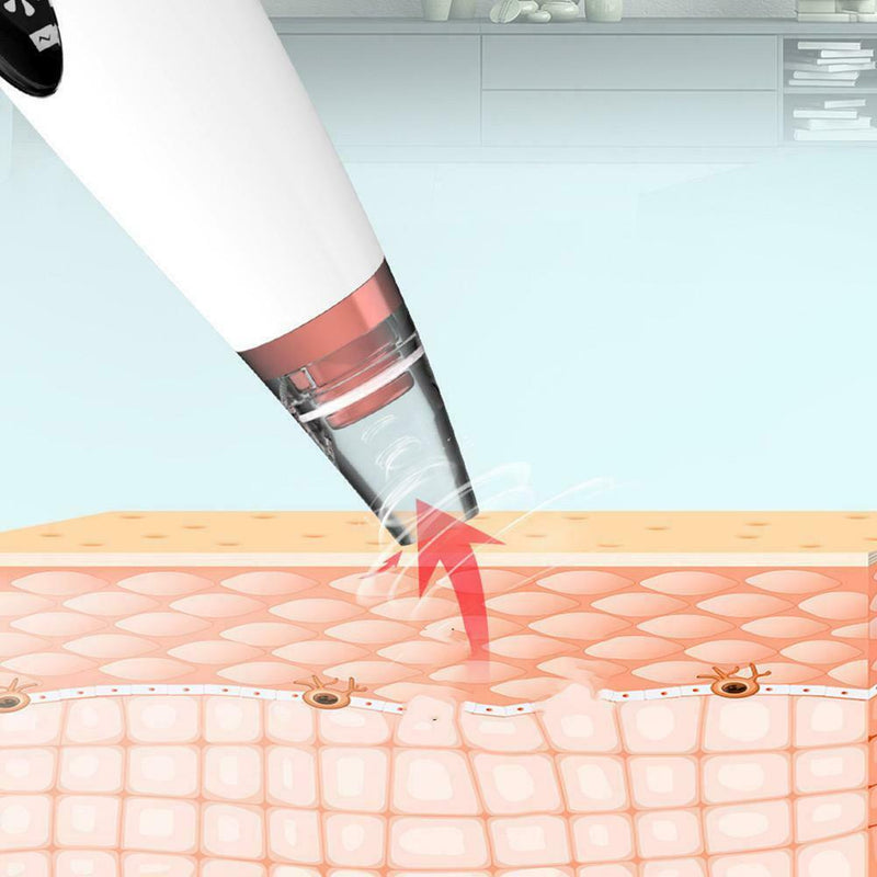 Blackhead Remover Vacuum Extractor Pro Suction Facial Pore Acne Cleaner Effectiv