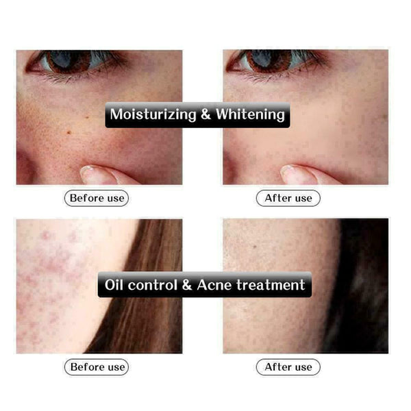 Hyaluronic Acid Anti WRINKLES Collagen Skin Young New S6V8 Z6P4 J8B8