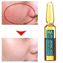 Hyaluronic Acid Ampoule Face Serum Shrink Pores Anti-Ance Nicotinamide H1Z7 X7K6