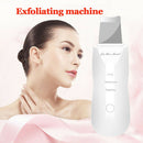 Ultrasonic Skin Scrubber Peeling Shovel Ion Exfoliating Dead Skin Remover