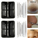 9x Blackhead Remover Tool Kit Spot Acne Pimple Comedone Extractor Popper Come JR