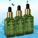 Shrink Pores Essence Facial Serum Blackhead Acne Face Essence Oil E5A0 O3W0