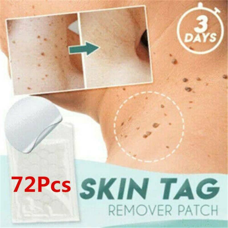 72PCS Skin Tag & Acne Patch - 2021 NEW Hydrocolloid Acne and Skin Tag Remover
