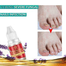 Nail Treatment Essential Oil Nail Nourishing Brightening Promote Nails Foot Y2J3