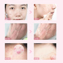 Hemeiel Deep Clean Hyaluronic Acid Exfoliating Peeling Gel Smoothen Facial