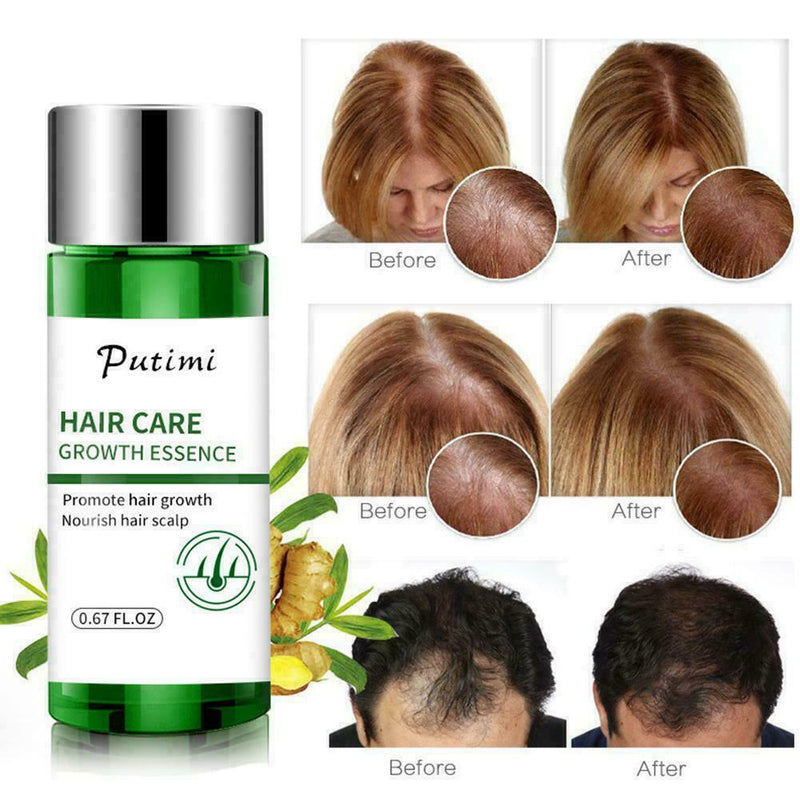 Hair Growth Dense Regrowth Ginger Serum Oil Anti Loss Treatment Essence 20M T1W7