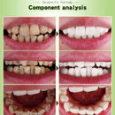 Meiyanqiong Dental Brightening Pen Oral Hygiene Essence Teeth Whitening Ser