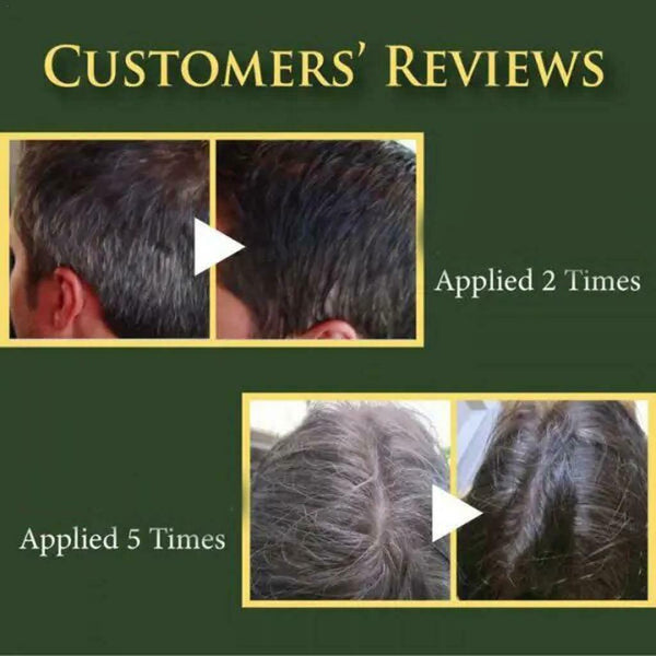 Refreshing Antidandruff Shampoo Shiny Thick Shampoo Black Hair Care Shampoo
