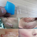 3.5*12cm Silicone Gel Scar  Patch 1 Piece Dilute the scar 3C