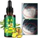 30ml Extract Hair Growth Essence Oil Anti Hair Loss Fast Restoration Growth X9H6