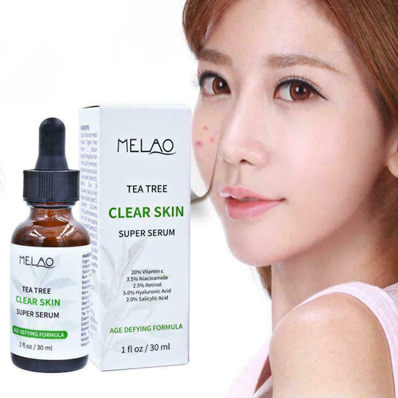 Pure Natural Tree Essential Oil Acne Treatment Face Z Skin Care Z1R9