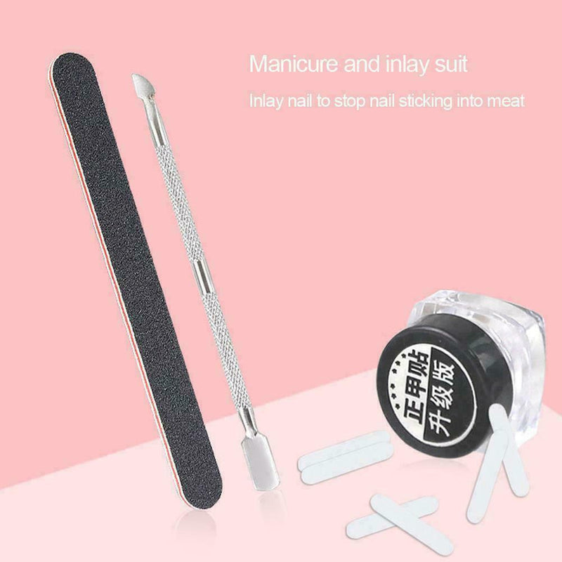 Ingrown Toenail Straightening Clip Glue Correction Curved Hot Brace Kit P3Y8