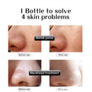 Rorec Serum Facial Hyaluronic Acid Essence Face Serum Skin Care Shrink Pore Z1M2