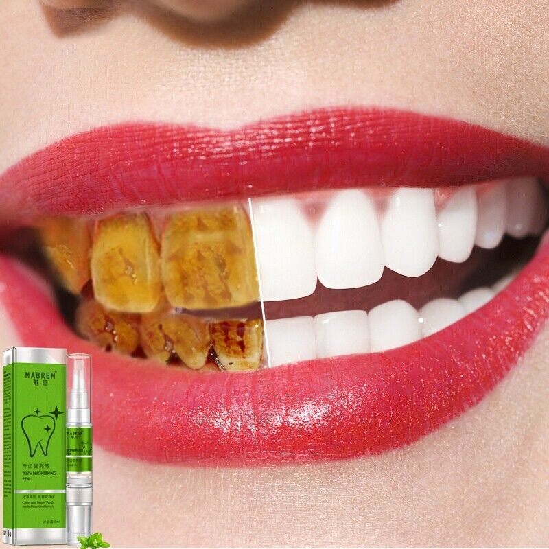 Meiyanqiong Dental Brightening Pen Oral Hygiene Essence Teeth Whitening Ser V6R4