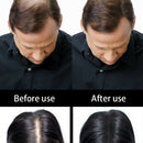 sevich Keratin Hair Building Hairdressing Combs Hairline Optimizer 1Pcs/Lot L4V5