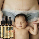 Lavender Essence Skin Care Natural Pure Remove Ance Mark Burn Strentch Remo H0D9