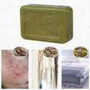 Natural Herbal Handmade Soap Anti Acne Oil Control Cleansing Soap Skin Care