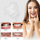 Temporary Tooth Replacement Material - 12 grams, 20ml, Kit teeth Repair 12- M7M4