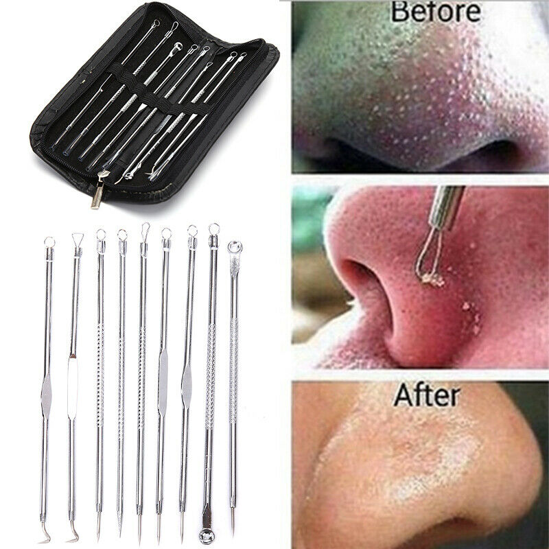 9pcs Blackhead Pimple Blemish Comedone Acne needle Extractor Remover Tool Se Gw