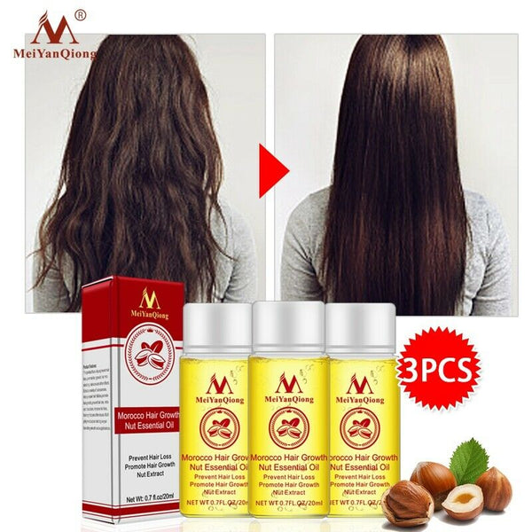 MeiYanQiong Morocco Nuts Hair Fast Powerful Growth Essence 3PCS Preventing  Q2Z9