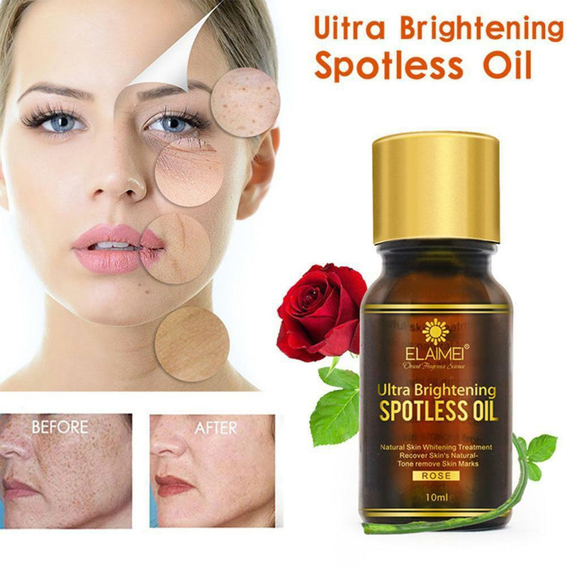 Rose Brightening Spotless Oil Skin Care Natural Pure Remove Dark Spots 10ML