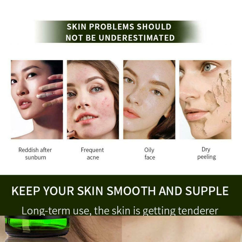 30ml Aloe Essence Moisturizing And Soothing Liquid Glass Dropper Bottle