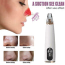 Electric Blackhead And Acne Pores Vacuum Suction Microdermabrasion Cleaner L9N6