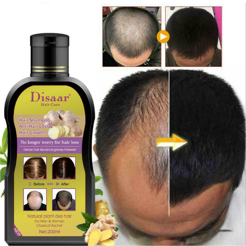 200ml Men Women Hair Shampoo Anti hair Loss Chinese Herbal Hair Growth